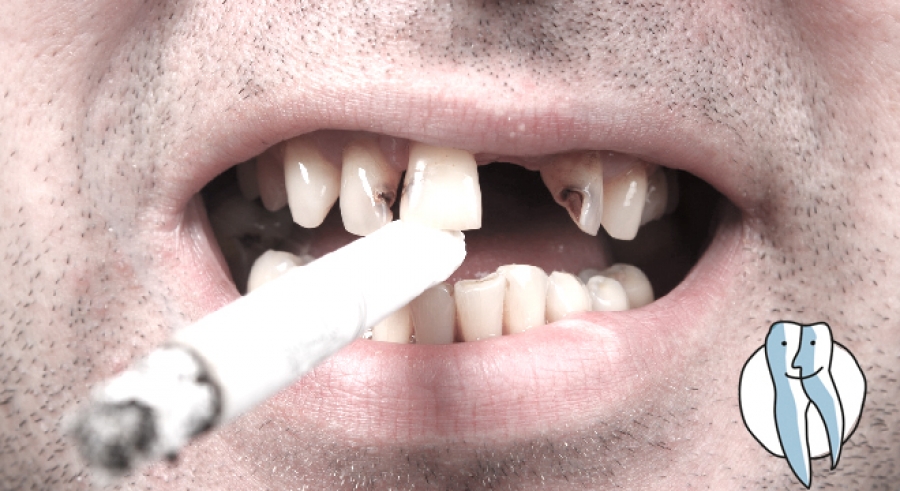 Rauchen putzen 🎉 zähne nach dem Zähne putzen